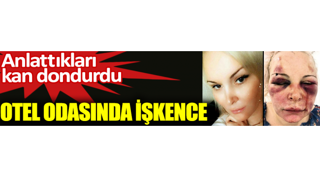 Otel odasında işkence. Anlattıkları kan dondurdu 