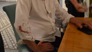 CHPLİ BELEDİYE BAŞKANINA SALDIRI !